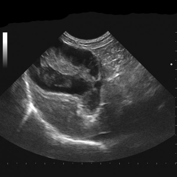 ultrasound-mucocele